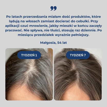 Serum Avéna™ - Pobudź wzrost włosów z aplikatorem kulkowym